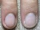 ビー(b.)の写真/【初心者が8割◇完全個室】割れ爪/ささくれ/爪の形…男性が持つ爪悩み専門◆接客業/営業職/美容師さんにも!