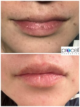 ヒルナム(Heal Nam)/プロセルセラピーズ~フェイス~