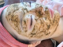 リリアン(Re Lien)/ハーブピーリングでニキビケア