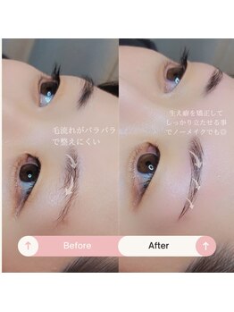 シャルトルズ/症例写真３