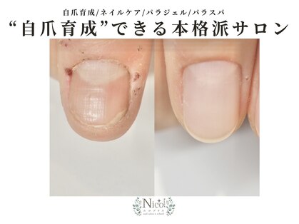 ニコプラス(NICO+)の写真
