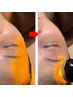 【アドバンス小顔】お顔の筋トレ◆立体小顔コルギ＋EMS表情筋ケア