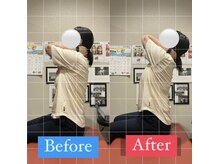 ナオル整体 宮崎院(NAORU整体)/20代女性施術事例【肩こり改善】