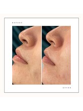 ブランスキンラボ(BLANC.skin LAB)/フェイスワックス 