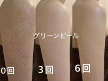 バービーグロウ 恵比寿(Barbie Glow)の雰囲気（グリーンピール認定サロン★二の腕／背中／顔／脚／肌質改善）