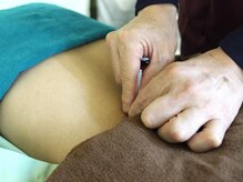 いなほ はりきゅう整骨院 東新宿/鍼灸(吸い玉併用)コース