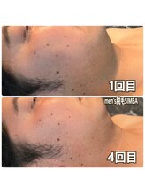 シンバ 倉敷店(SIMBA)/