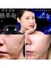 【プラズマ７つの効果】最新肌管理で美肌革命★シミ・毛穴・ニキビケア