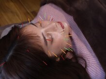 カナヤ鍼灸整骨院の雰囲気（20代～80代まで！幅広い年齢層に人気のメニュー！美容鍼/美顔鍼）