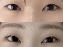 シャール(shall)/まつ毛パーマ/まつげ/マツパ