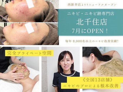 ニキビケア研究所 北千住店の写真