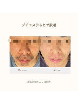 癒し処 ほっこり 海田店/【ビフォーアフター】