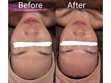 レアナ(LEANA)/全身痩身90分＆フェイシャル60分