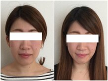 美容整体 ウェリナ 蟹江院/小顔矯正/骨盤矯正/美脚サロン