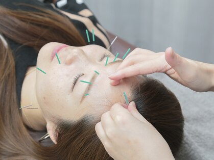 マカナ接骨院(Makana接骨院)の写真