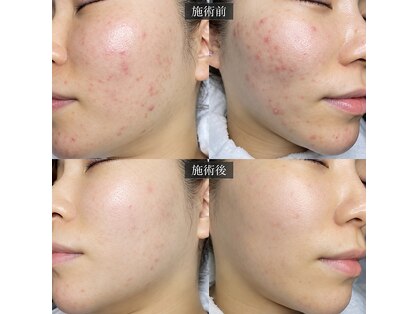 チョンダムビューティー(chondam beauty)の写真