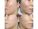 チョンダムビューティー(chondam beauty)の写真