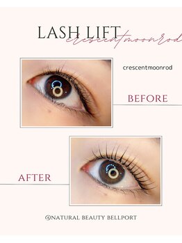 ナチュラル ビューティー ベルポート(natural beauty Bellport)/ラッシュリフトビフォーアフター