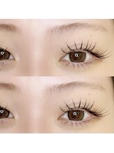 トゥービー(To Be)/バインドロック