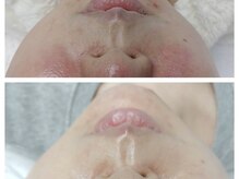 チャーム 草津東口店(Charm)/【ララピール】