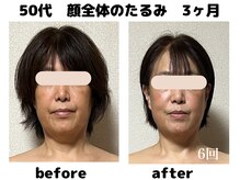 フェリーチェ(FELICE)/◆顔が上がると気分もアップ♪