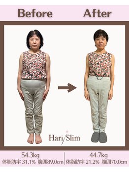 ビーネ 札幌琴似/ハリスリム 札幌琴似(Beene/Hari-Slim)/3ヶ月-9.7kg