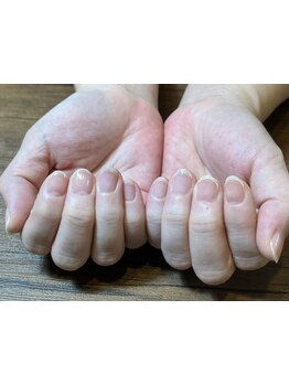 爪の悩みを解消できる（ケア含む）