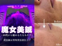 ハリス 坂出(HARIS)