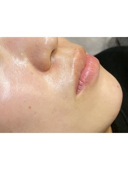 毛穴ケアをしたい