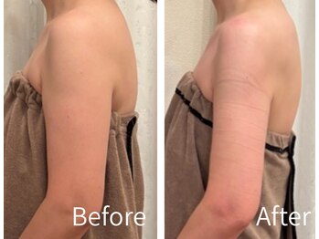 ミント(Mint)/むくみも脂肪もスッキリ