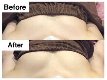 ナトゥーラ チュチュ(natura chuchu)/左右差も改善し美バストへ★梅田