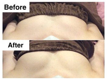 ナトゥーラ チュチュ(natura chuchu)/左右差も改善し美バストへ★梅田