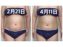 ハロ 南青山(HALO)/レモンボトルお腹×3回