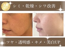 ラナビューティリゾート(Lana Beauty resort)の雰囲気(今の肌悩みに向き合い、未来の素肌を育てる☆)