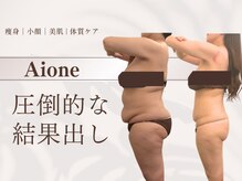 アイワン トータルビューティ(Aione totalbeauty)
