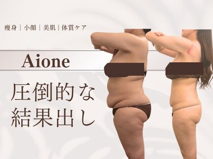 アイワン トータルビューティ(Aione totalbeauty)の写真