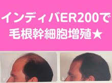 オリエンタルローザ 表参道(Oriental Rosa)/インディバER200ヘッド10分¥2200