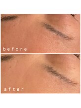 メナードフェイシャルサロン 岐阜茜部/うるおい補給、乾燥対策