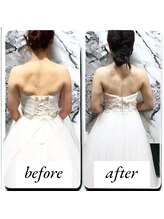 ラグラン銀座メディカルエステ 高輪ゲートウェイ店/＼ブライダル／プレ花嫁のお客様