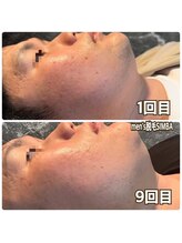 シンバ 倉敷店(SIMBA)/