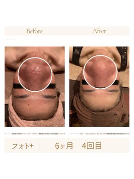 ガムラン(Gamelan)/フォト＋（6ヶ月　4回目）