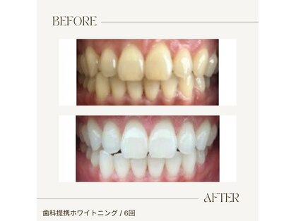 オリス(Oris)の写真