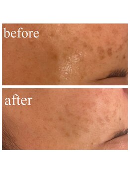 ディス イズ ミー エステティック(This is Me Aesthetic)/シミケア