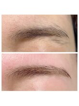 リノア(Linoa)/Wax脱毛（間引き、カット込み）