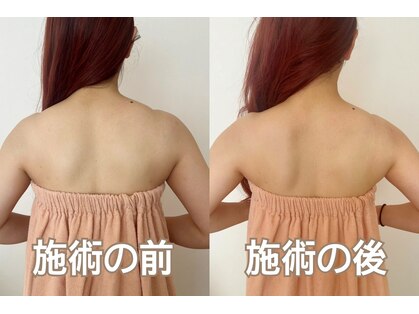 れふぇるん 足利店の写真