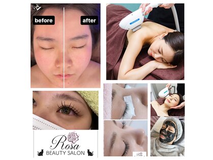 ロサ(Rosa)の写真