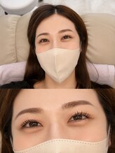 アンドラッシュ(&lash)