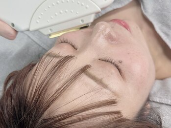 サロン カレナ(salon KARENA)の写真/顔脱毛で毛穴レス肌へ!一緒に理想のツルツル卵肌を目指しましょう♪誰もが憧れる水光肌へ★