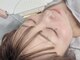 サロン カレナ(salon KARENA)の写真/顔脱毛で毛穴レス肌へ!一緒に理想のツルツル卵肌を目指しましょう♪誰もが憧れる水光肌へ★