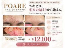 ポアレ(POARE)